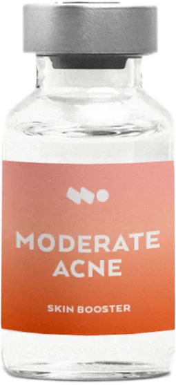 MODERATE ACNE