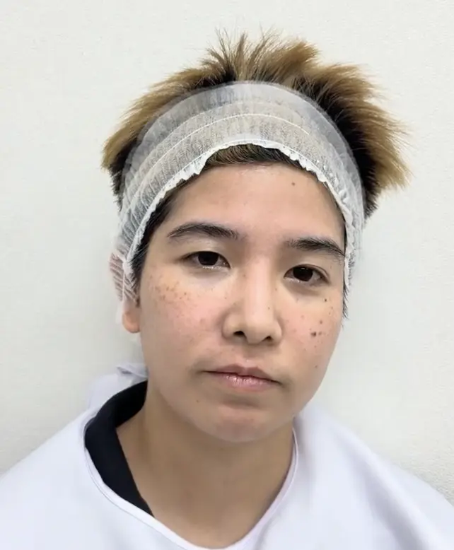 Before